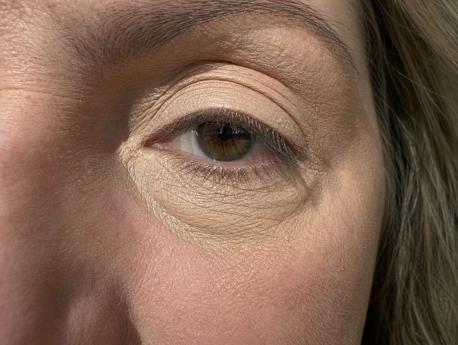 Concealer creasing into fine lines